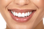 Coupons for White Teeth